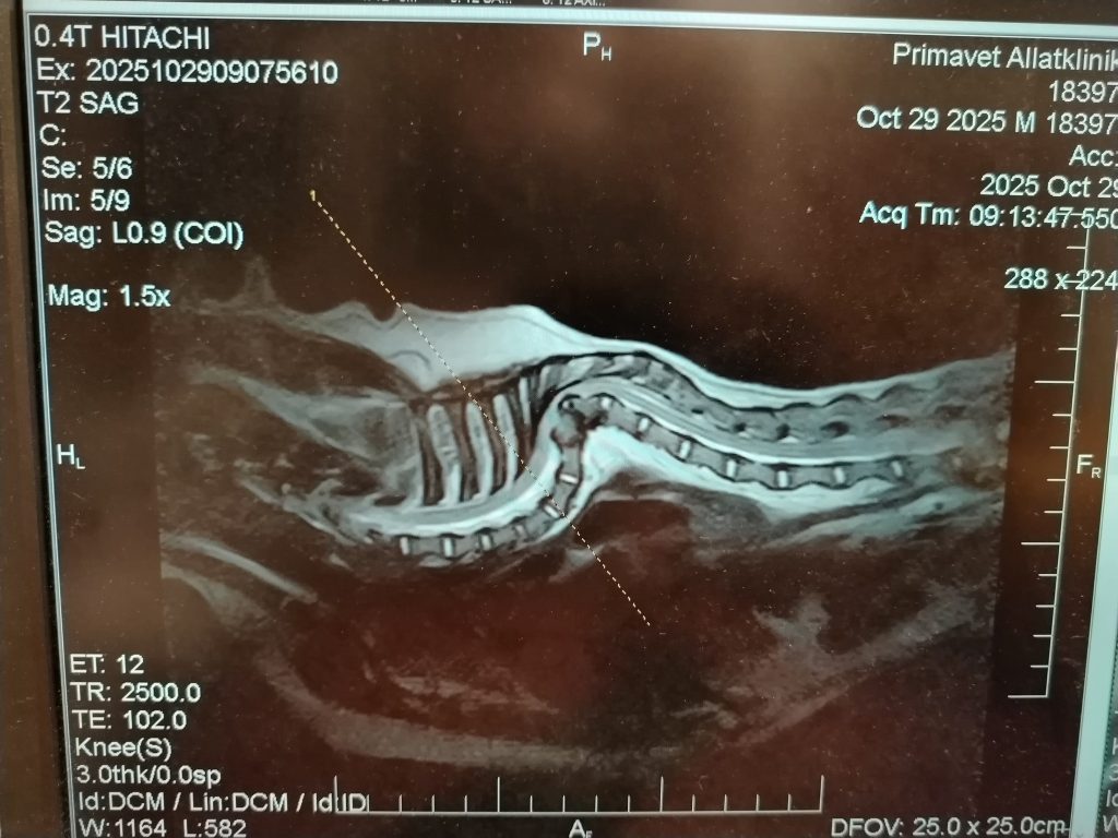 MRI és döntés: van-e még esély Zsömi számára? MRI és döntés: van-e még esély Zsömi számára?